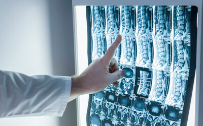 ¿Qué pruebas diagnósticas se usan para problemas de dolor de espalda? 