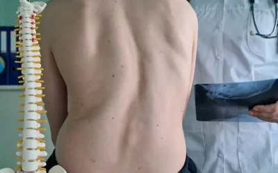 Escoliosis degenerativa: qué es, síntomas y cuándo consultar 